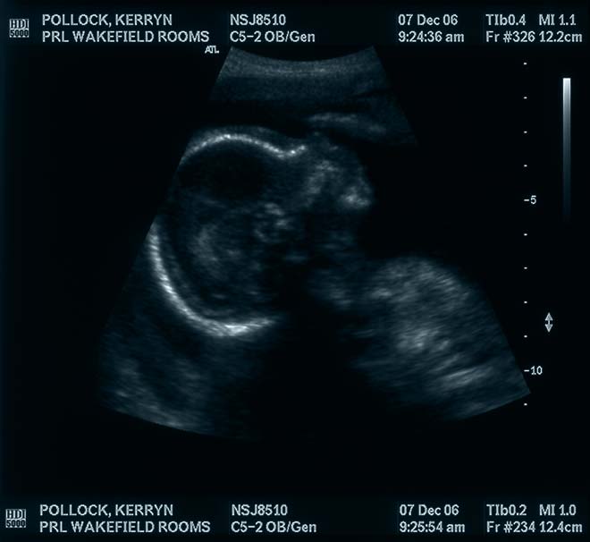 Ultrasound image, 2007
