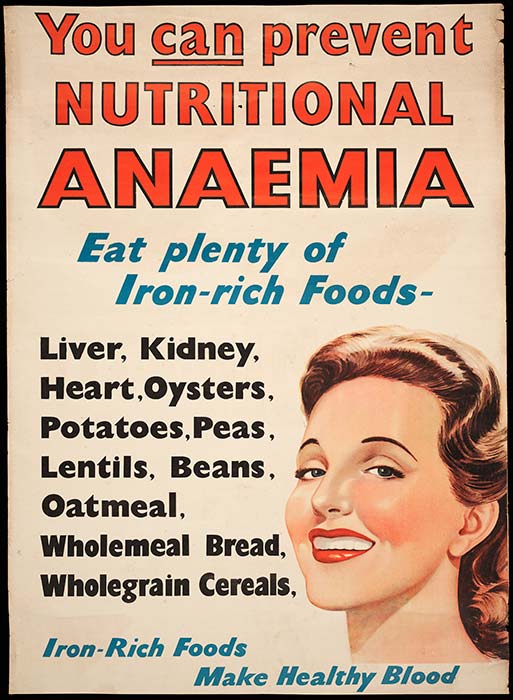 Nutritional anaemia poster, 1940s