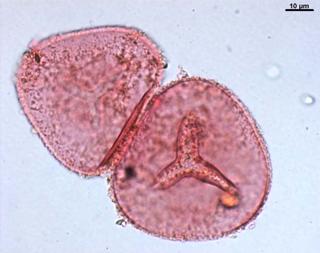 A magnified bracken spore
