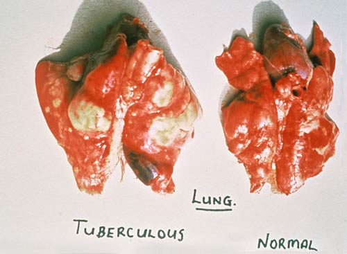 Possum lungs