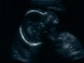 Ultrasound image, 2007