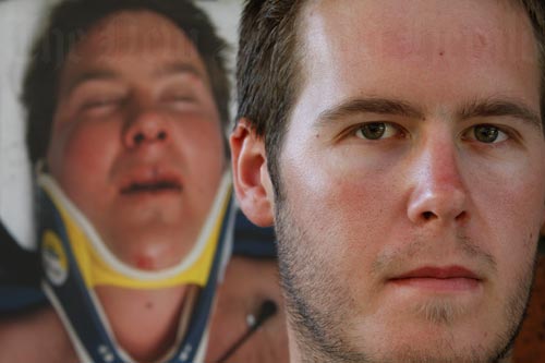 Assault victim
