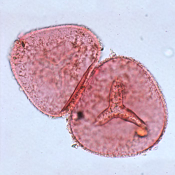 A magnified bracken spore