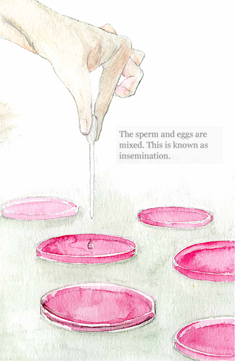 Insemination