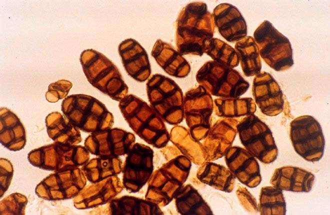 Spores of facial eczema fungus