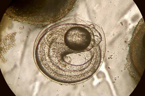 Embryo