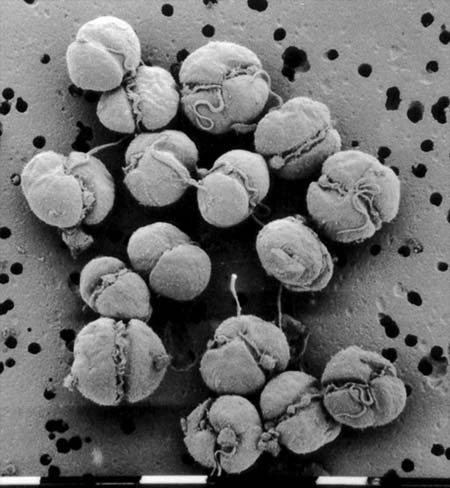 The toxic <em>Karenia brevisulcata</em>