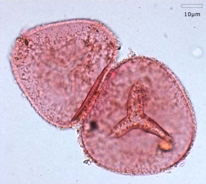 Magnified bracken spore