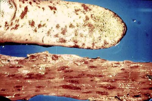Viral diarrhoea in cattle