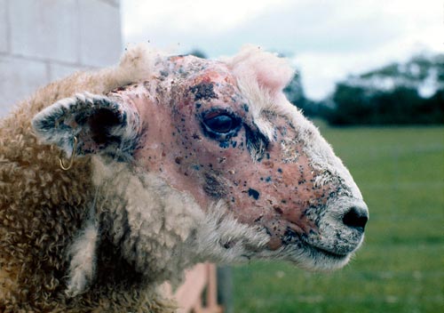 Facial eczema