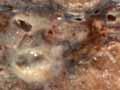 Diseased and healthy lung 