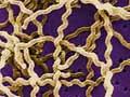 Leptospirosis