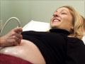 Ultrasound scan
