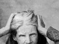 Woman patient, Seacliff