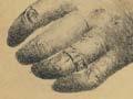 Drawing of 'The hand found at Taylor's Mistake'