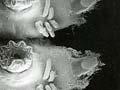 Suction cups