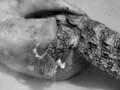 Tuatara hatching