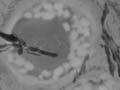 <em>Cyanidium</em> cells