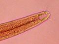 Marine roundworm