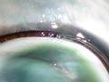 Cat’s eye in shell