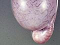<em>Brucella ovis</em> infection