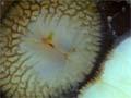 Sea snail’s radula