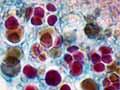 Cross section of a lichen