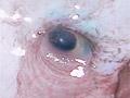 Blobfish and snailfish