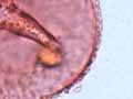 Magnified bracken spore